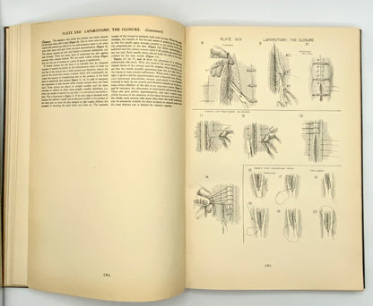 Ah/ Atlas of Surgical Operations by Elliott C. Cutler 1939