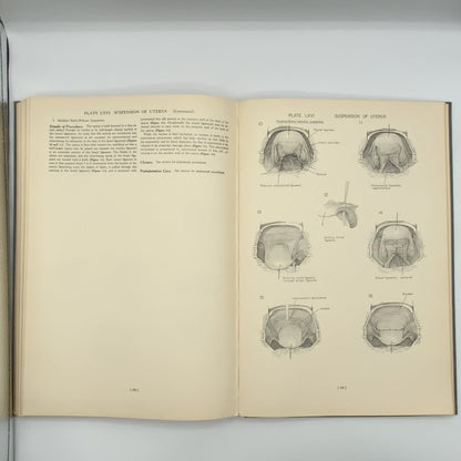 Ah/ Atlas of Surgical Operations by Elliott C. Cutler 1939